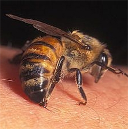 укус пчелы, осы, шмеля